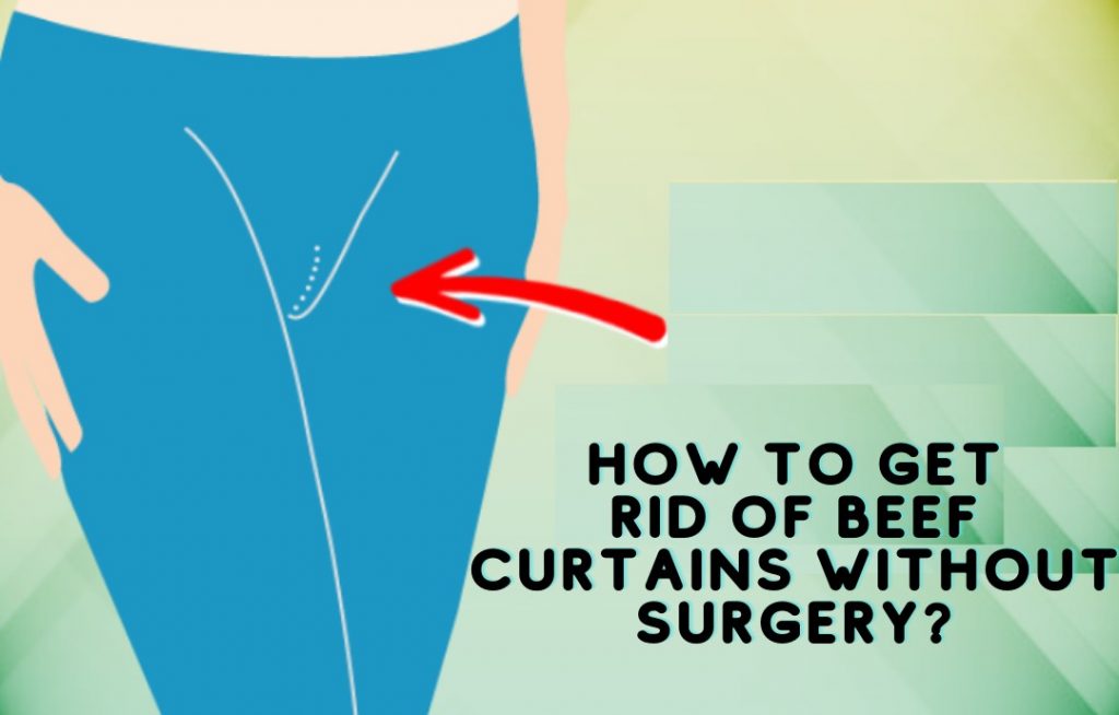 How to Get Rid of Beef Curtains Without Surgery